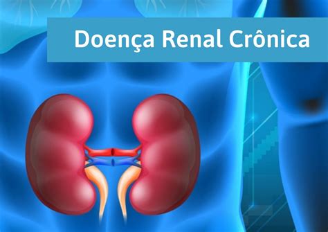 cid doença renal cronica